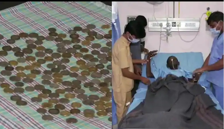 कर्नाटक: मरीज के पेट से डॉक्टरों ने निकाले 1.5 किलोग्राम के 187 सिक्के, पेट दर्द की थी शिकायत