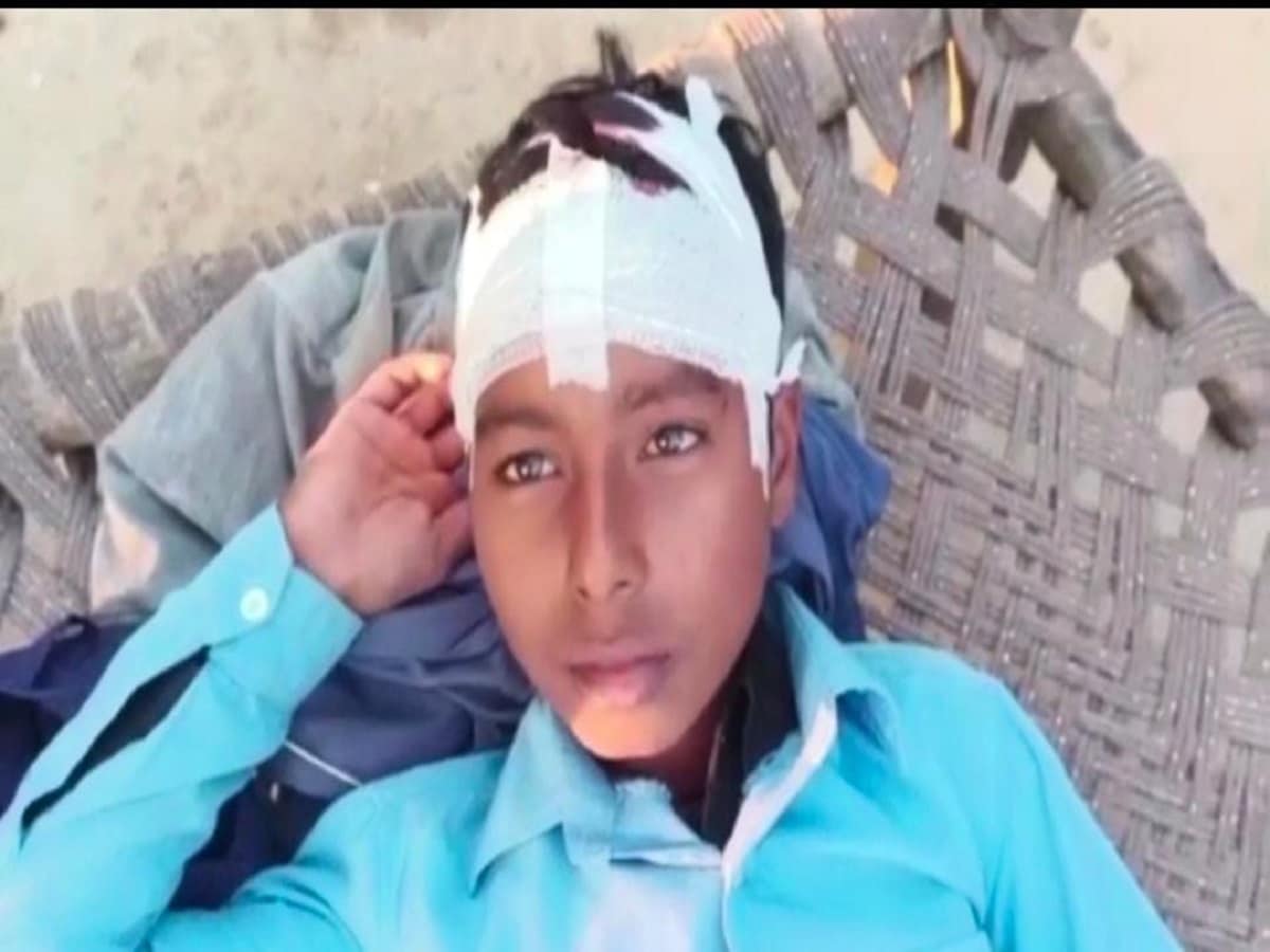 UP News : फ़तेहपुर जिले में टीचर ने छात्र की बेरहमी से कि पिटाई, सिर में लगे कई टांके