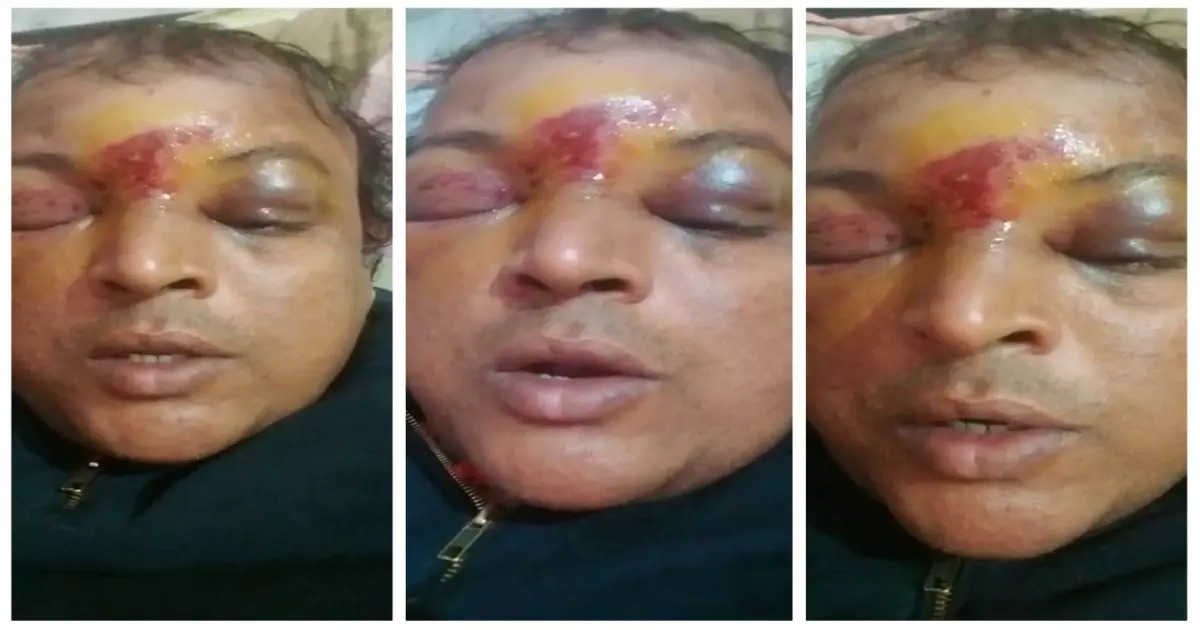 बिहार: परीक्षा केंद्र पर मजिस्ट्रेट पर जानलेवा हमला, छात्रों के एक ग्रुप ने लाठी-डंडे से उन्हें बुरी तरह पीटा