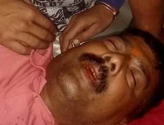 कानपुर में निर्दलीय प्रत्याशी के पति को मारी गोली, हालत गंभीर