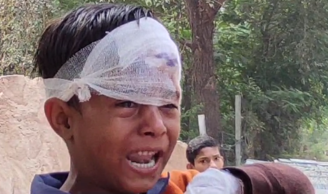 जालौन में स्कूली वैन खंभे से टकराई, 11 बच्चे घायल, तीन गंभीर