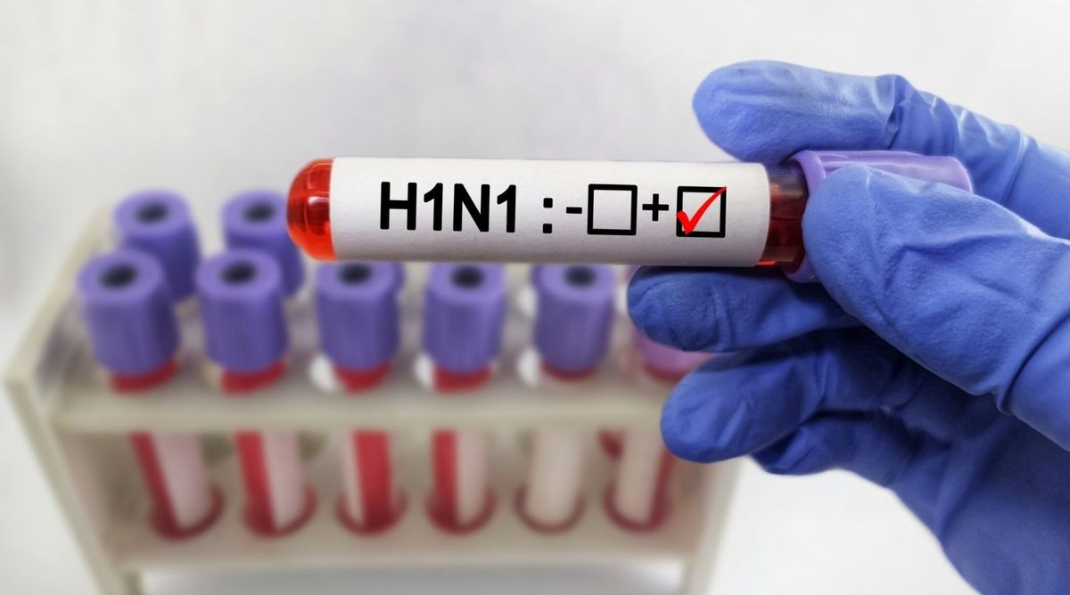 झारखंड में H1N1 की दस्तक! 8 सैंपल पॉजिटिव, स्वास्थ्य विभाग अलर्ट